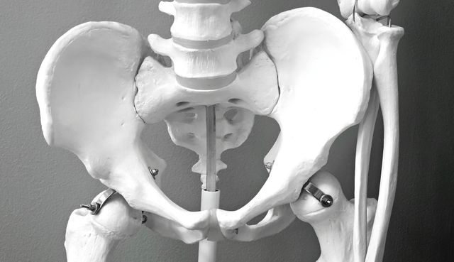 Hip Replacement Surgery